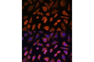 Immunofluorescence analysis of L-929 cells using N-WASP/WASL Polyclonal Antibody (ABIN3016273, ABIN3016274, ABIN3016275, ABIN1683282 and ABIN6219682) at dilution of 1:100 (40x lens). (Neural Wiskott-Aldrich syndrome protein (WASL) (AA 1-250) antibody)
