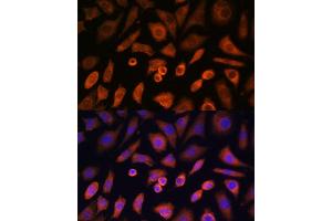 Immunofluorescence analysis of L-929 cells using N-WASP/WASL Polyclonal Antibody (ABIN3016273, ABIN3016274, ABIN3016275, ABIN1683282 and ABIN6219682) at dilution of 1:100 (40x lens). (Neural Wiskott-Aldrich syndrome protein (WASL) (AA 1-250) antibody)