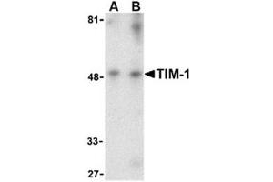 Image no. 1 for anti-Hepatitis A Virus Cellular Receptor 1 (HAVCR1) (Middle Region) antibody (ABIN318765)