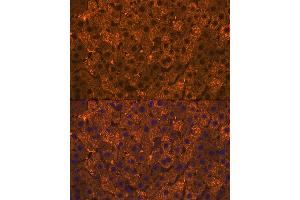 anti-Sulfotransferase Family, Cytosolic, 2A, Dehydroepiandrosterone (DHEA)-Preferring, Member 1 (SULT2A1) antibody