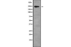 Western blot analysis of CCDC131 using Jurkat whole cell lysates (ZFC3H1 antibody  (Internal Region))