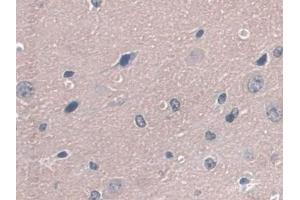 Detection of GPX3 in Mouse Cerebrum Tissue using Polyclonal Antibody to Glutathione Peroxidase 3, Plasma (GPX3) (GPX3 antibody  (AA 3-72))