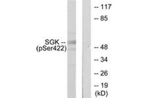 Western blot analysis of extracts from HeLa cells treated with Insulin 0. (SGK1 antibody  (pSer422))