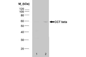 Western blot analysis of HeLa whole cell lysate (1) and HeLa heat stressed whole cell (CCT2 antibody)