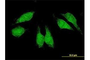 Immunofluorescence of purified MaxPab antibody to CRKL on HeLa cell. (CrkL antibody  (AA 1-303))