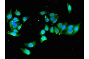 Immunofluorescent analysis of PC-3 cells using ABIN7166338 at dilution of 1:100 and Alexa Fluor 488-congugated AffiniPure Goat Anti-Rabbit IgG(H+L) (YIPF3 antibody  (AA 2-148))