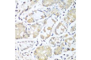 Immunohistochemistry of paraffin-embedded human stomach using RPH3AL antibody. (RPH3AL antibody)