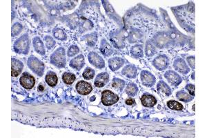 IHC analysis of IGF1 Receptor using anti-IGF1 Receptor antibody . (IGF1R antibody  (AA 31-257))