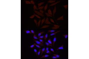 Immunofluorescence analysis of HeLa using FA/PIEZO1 antibody (ABIN6133207, ABIN6145612, ABIN6145613 and ABIN6220594) at dilution of 1:100 (40x lens). (PIEZO1 antibody  (AA 2230-2420))