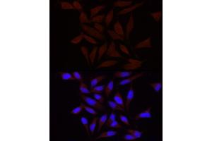 Immunofluorescence analysis of HeLa using FA/PIEZO1 antibody (ABIN6133207, ABIN6145612, ABIN6145613 and ABIN6220594) at dilution of 1:100 (40x lens). (PIEZO1 antibody  (AA 2230-2420))