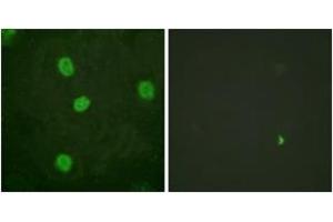 Immunofluorescence analysis of HeLa cells, using B-Myb (Phospho-Ser577/581) Antibody. (MYBL2 antibody  (pSer577))