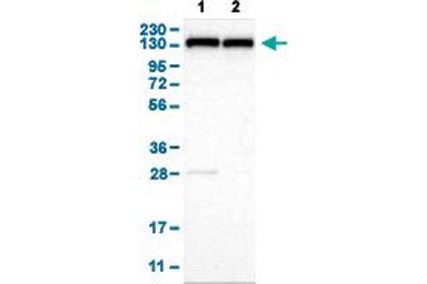 UBE4B Antikörper  (AA 2-67)