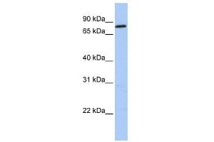 WB Suggested Anti-ZNF226 Antibody Titration:  0. (ZNF226 antibody  (C-Term))