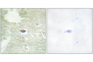 Immunohistochemistry (IHC) image for anti-Transforming Growth Factor, beta Receptor II (70/80kDa) (TGFBR2) (pSer225), (pSer250) antibody (ABIN7138491)