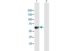 Western Blot analysis of TOM1 expression in transfected 293T cell line by TOM1 MaxPab polyclonal antibody. (TOM1 antibody  (AA 1-492))