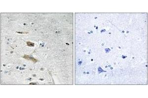 Immunohistochemistry analysis of paraffin-embedded human brain tissue, using ABHD4 Antibody. (ABHD4 antibody  (AA 251-300))