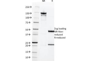 SDS-PAGE Analysis of Purified HCG-beta Rabbit Recombinant Monoclonal Antibody (HCGb/1996R). (Recombinant CGB antibody)