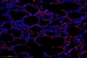 Immunofluorescent analysis of paraformaldehyde-fixed rat lung using,OMD (ABIN7074956) at dilution of 1: 1000 (Osteomodulin antibody)