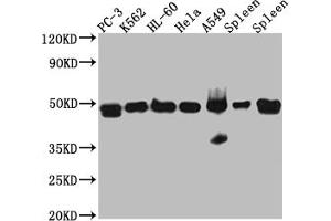 Western Blot Positive WB detected in: PC-3 whole cell lysate, K562 whole cell lysate, HL-60 whole cell lysate, A549 whole cell lysate, Mouse Spleen whole cell lysate, Rat Spleen whole cell lysate All lanes: Arp3 Antibody at 1:1000 Secondary Goat polyclonal to rabbit IgG at 1/50000 dilution Predicted band size: 48 kDa Observed band size: 48 kDa (Recombinant ACTR3 antibody)