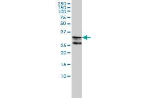 HNRPA2B1 monoclonal antibody (M01A), clone 1G12-6C5 Western Blot analysis of HNRPA2B1 expression in K-562 . (HNRNPA2B1 antibody  (AA 1-249))
