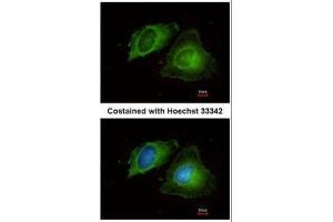 ICC/IF Image Immunofluorescence analysis of methanol-fixed HeLa, using MMP17, antibody at 1:200 dilution. (MMP17 antibody)