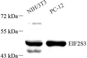 Western blot analysis of EIF2S3 (ABIN7073881),at dilution of 1: 1000 (EIF2S3 antibody)