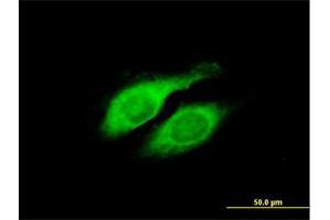 Immunofluorescence of purified MaxPab antibody to LYPLA2 on HeLa cell. (LYPLA2 antibody  (AA 1-231))