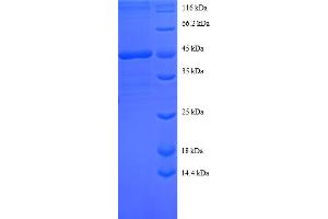 SDS-PAGE (SDS) image for Sorting Nexin 3 (SNX3) (AA 3-162) protein (GST tag) (ABIN4976145)