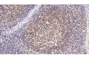 Detection of EP300 in Human Lymph node Tissue using Polyclonal Antibody to E1A Binding Protein P300 (EP300) (p300 antibody  (AA 1351-1601))