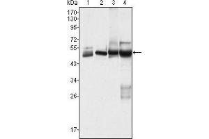 Western blot analysis using CK7 mouse mAb against Hela (1), MCF-7 (2), A431 (3) and A549 (4) cell lysate. (Cytokeratin 7 antibody)