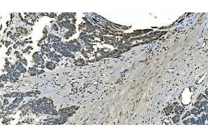 IHC analysis of LSM8 using anti-LSM8 antibody (ABIN7599579).
