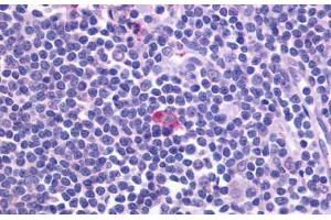 Anti-CXCR5 antibody  ABIN1048479 IHC staining of human spleen. (CXCR5 antibody  (Cytoplasmic Domain))