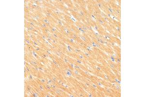 Immunohistochemistry of paraffin-embedded rat heart using MYBPC3 antibody (ABIN6129601, ABIN6144221, ABIN6144222 and ABIN6215951) at dilution of 1:100 (40x lens). (MYBPC3 antibody  (AA 200-400))