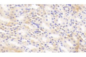 Detection of b2M in Mouse Kidney Tissue using Polyclonal Antibody to Beta-2-Microglobulin (b2M) (beta-2 Microglobulin antibody  (AA 22-119))