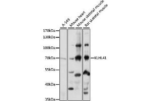 Western blot analysis of extracts of various cell lines, using KLHL41 antibody (ABIN7268084) at 1:1000 dilution. (Kelch-like protein 41 (KLHL41) (AA 1-300) antibody)