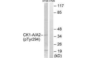 Western blot analysis of extracts from HT-29 cells treated with heat shock using CK-1α (Phospho-Tyr294) Antibody. (CSNK1A1 antibody  (pTyr294))