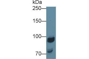 Detection of NAGLU in Porcine Kidney lysate using Polyclonal Antibody to N-Acetyl Alpha-D-Glucosaminidase (NAGLU) (N-Acetyl alpha-D-Glucosaminidase (AA 485-743) antibody)