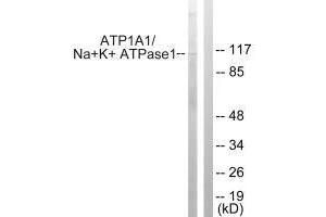 Western blot analysis of extracts from HeLa cells, using ATP1α1/Na+K+ ATPase1 (Ab-23) antibody. (ATP1A1 antibody  (Ser23))