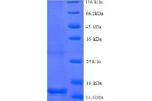 SDS-PAGE (SDS) image for BEN Domain Containing 3 (BEND3) (AA 328-461), (partial) protein (His tag) (ABIN5714376)