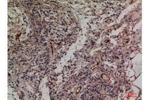 Immunohistochemistry (IHC) image for anti-Synaptosomal-Associated Protein, 23kDa (SNAP23) (C-Term) antibody (ABIN3187764)