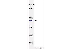 L1 rat brain lysates, L2 rat heart lysates probed (ABIN738351) Anti-SynCAM/TSLC1 Polyclonal, Unconjugated at 1:200 in 4 °C. (CADM1 antibody  (AA 365-442))