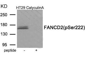 Western blot analysis of extracts from HT29 cells treated with CalyculinA using Phospho-FANCD2 (Ser222) antibody. (FANCD2 antibody  (pSer222))
