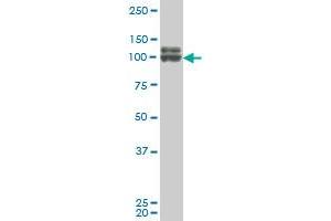 DDX54 monoclonal antibody (M02), clone 2E4 Western Blot analysis of DDX54 expression in A-431 .