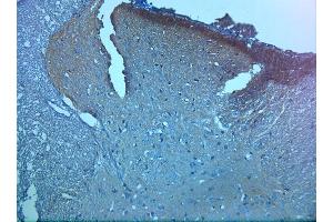IHC on paraffin sections of rat spinal cord tissue using Rabbit antibody to pro BDNF (50-90): . (Pro BDNF antibody)