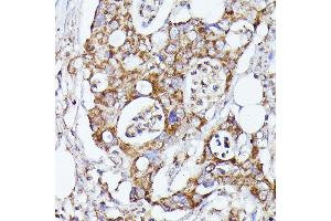 Immunohistochemistry (IHC) image for anti-CDK5 Regulatory Subunit Associated Protein 1 (CDK5RAP1) (AA 1-350) antibody (ABIN7266235)