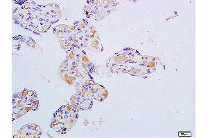 Formalin-fixed and paraffin embedded mouse intestine labeled with Anti ASBT/SLC10A2 Polyclonal Antibody, Unconjugated (ABIN755143) at 1:200 followed by conjugation to the secondary antibody and DAB staining.