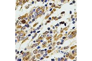 Immunohistochemical analysis of ACAD9 staining in human stomach formalin fixed paraffin embedded tissue section. (ACAD9 antibody)