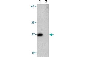 Western blot analysis of PRTFDC1 in human brain tissue lysate with PRTFDC1 polyclonal antibody  at 1 ug/mL in the (Lane 1) absence and (Lane 2) presence of blocking peptide. (PRTFDC1 antibody  (Internal Region))