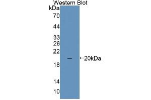 Western blot analysis of the recombinant protein. (IL1F9 antibody  (AA 5-153))