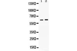 Western blot analysis of SCTR expression in rat kidney extract ( Lane 1) and SKOV3 whole cell lysates ( Lane 2). (SCTR antibody  (C-Term))
